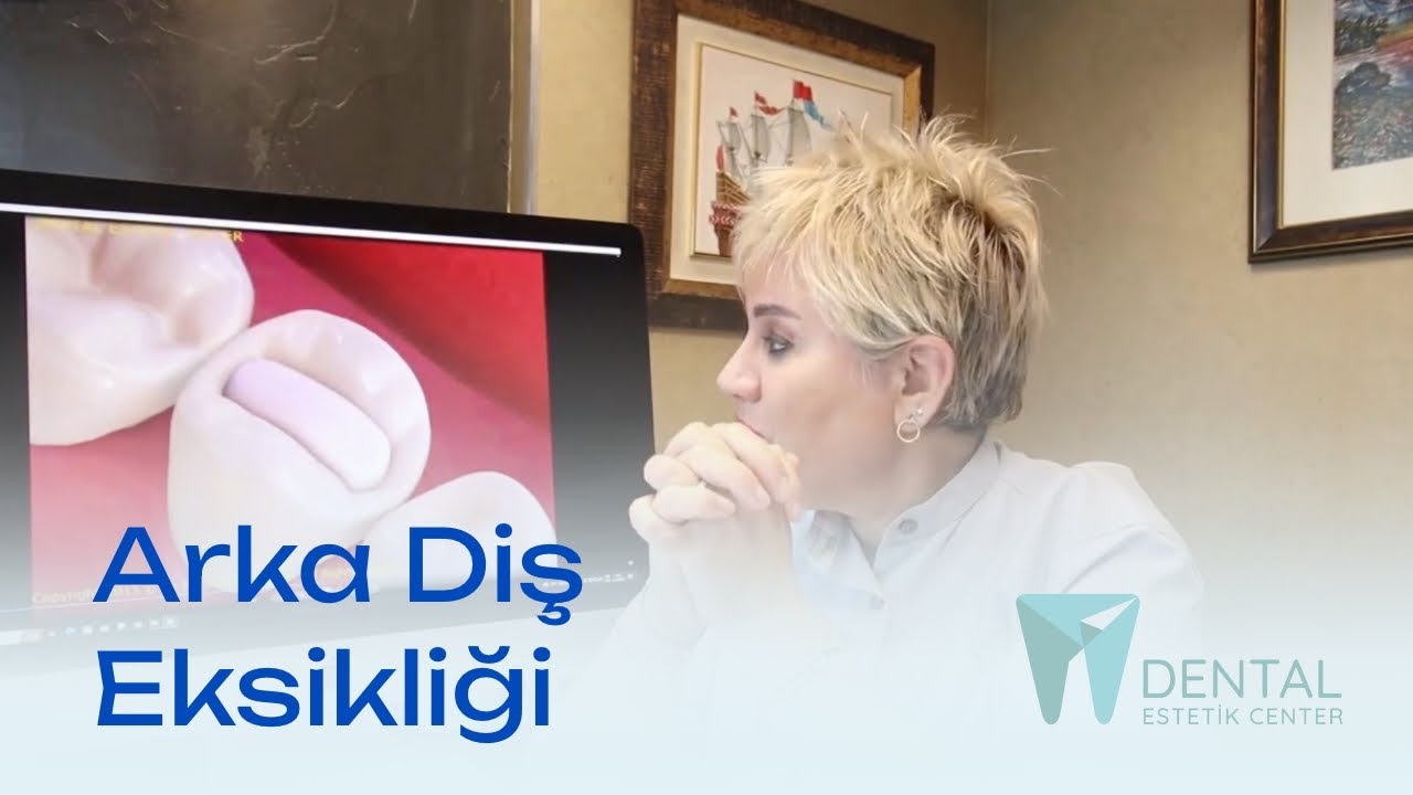 Arka Diş Eksikliğinde Köprü Tedavisi