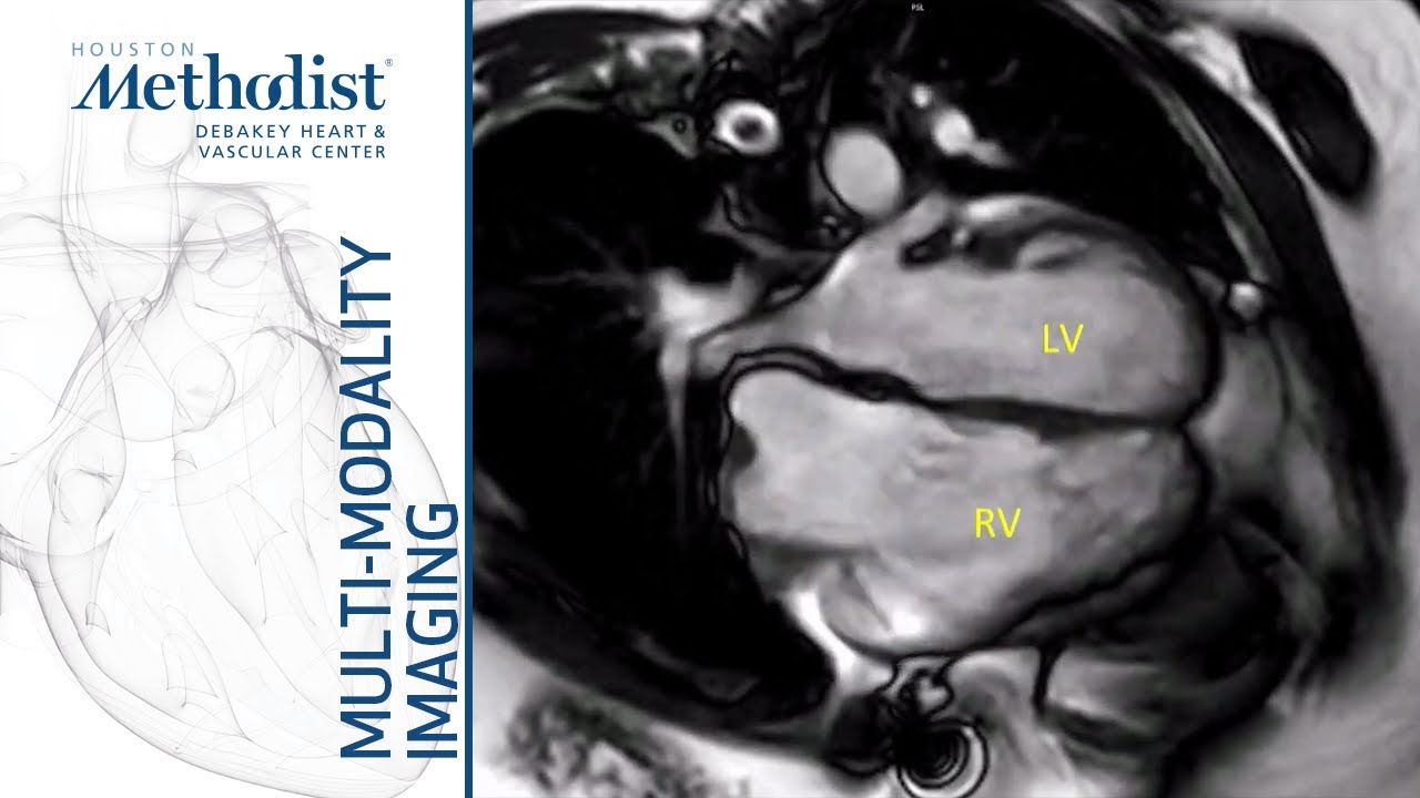 Congenital Heart Disease II&ndash;Imaging of Complex Congenital Lesions (Valeria Duarte, MD) April 7, 2020