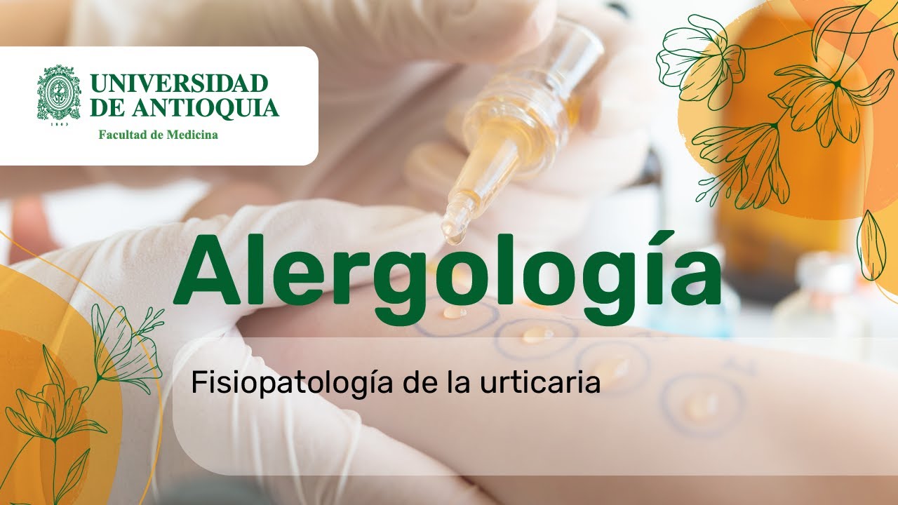Fisiopatología de la urticaria - Dra. Lina Arroyo
