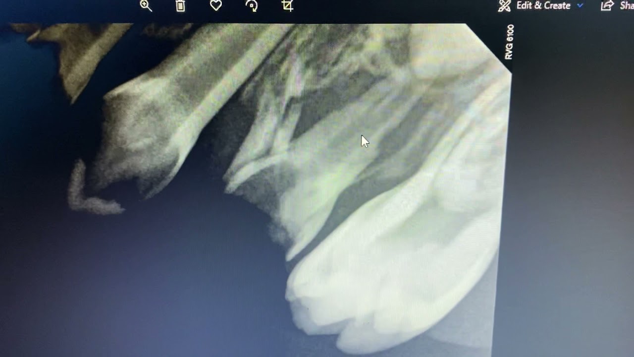 The indications of extraction in primary teeth