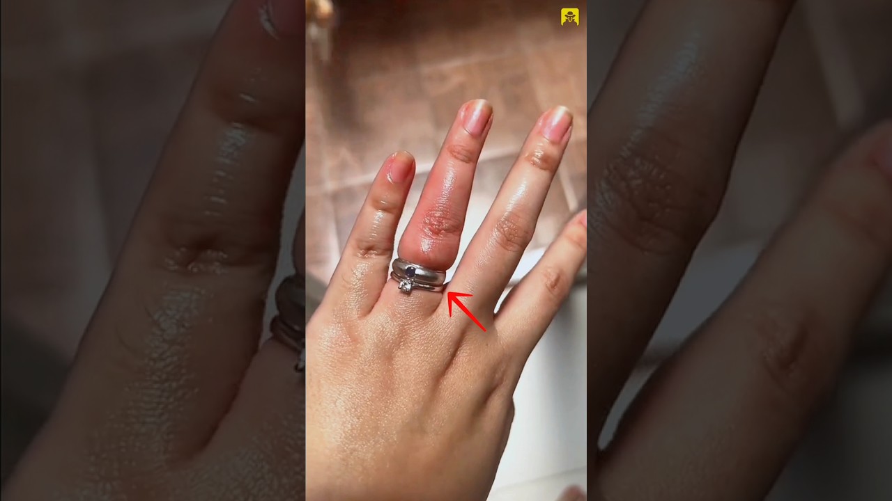 How to Remove a Ring Stuck on Your Finger #shorts