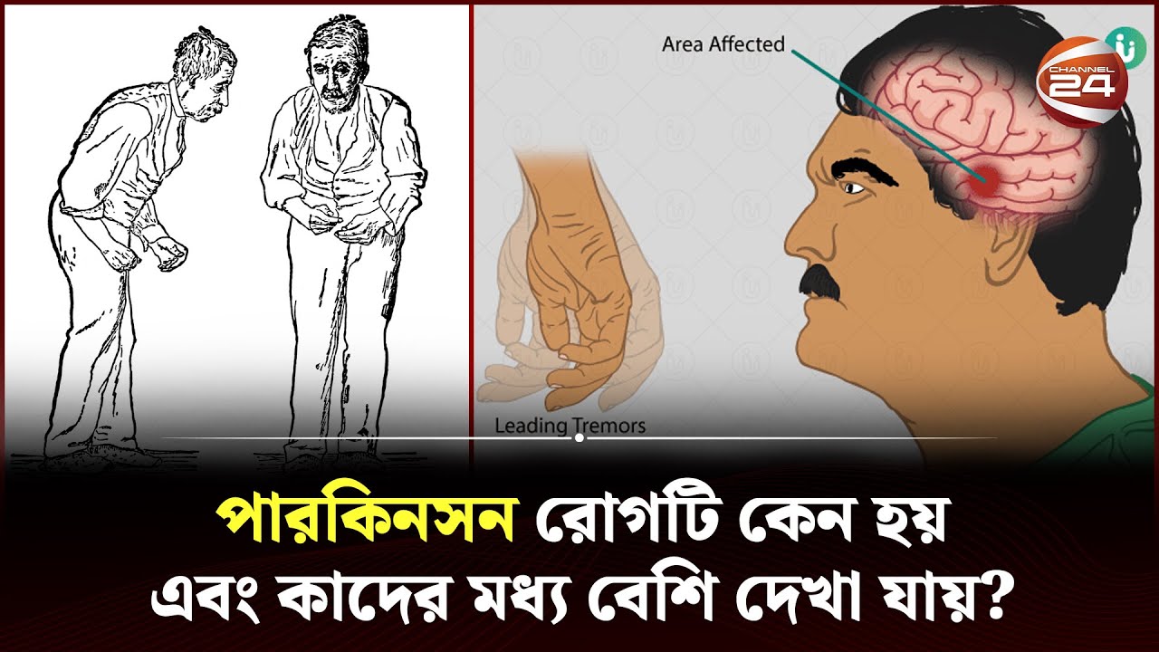 পারকিনসন রোগটি কেন হয় এবং কাদের মধ্য বেশি দেখা যায়? | Parkinson | Brain Disease | Channel 24