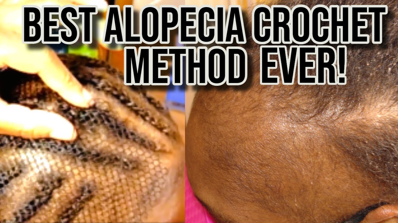 THE BEST EVER l ALOPECIA l CROCHET PASSION TWIST METHOD