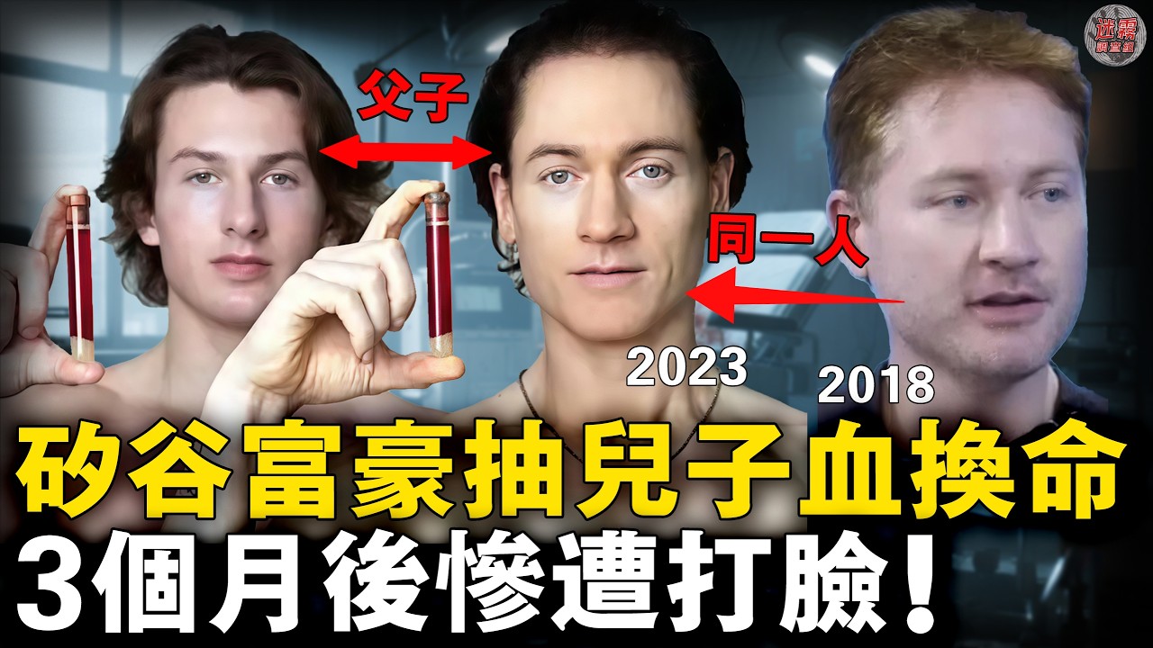 起底矽谷抗衰騙局：富豪砸錢嗑藥換血，卻差點被神藥送走😱背後產業鏈賺麻了！【迷霧調查組】 富豪八卦 名人故事 社會奇聞