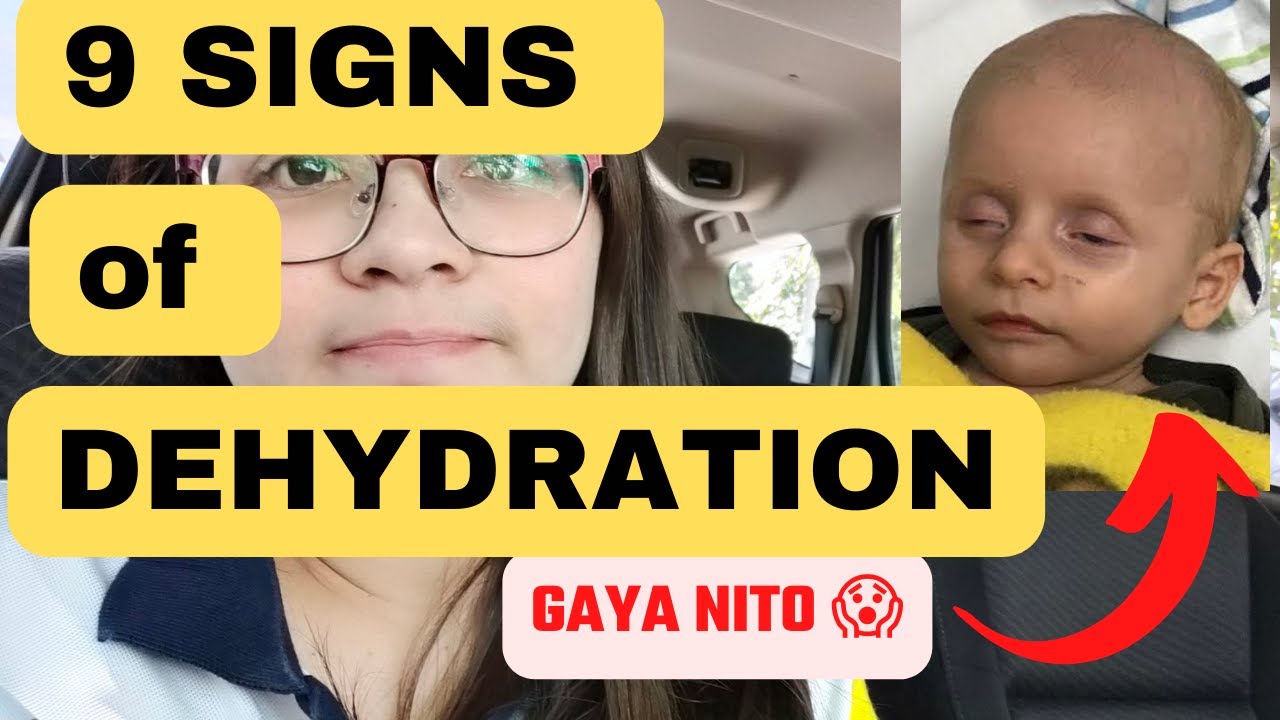 kapag NAGTATAE at SUKA si baby ... ito ang babantayan ninyo| Signs of Dehydration by Dr. Pedia Mom