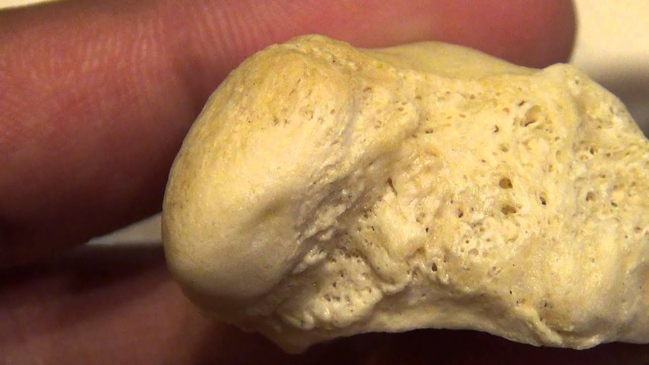 Anataomy and Osteology of the Navicular