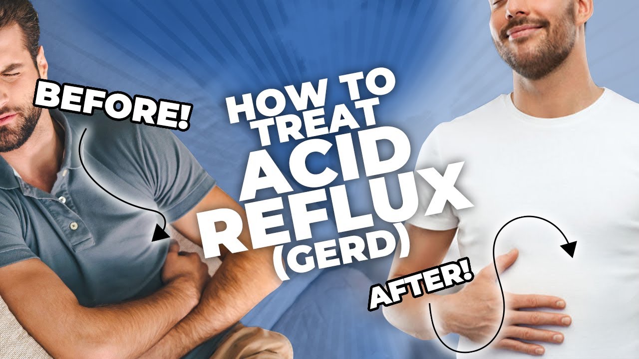 How To Treat Acid Reflux (GERD)