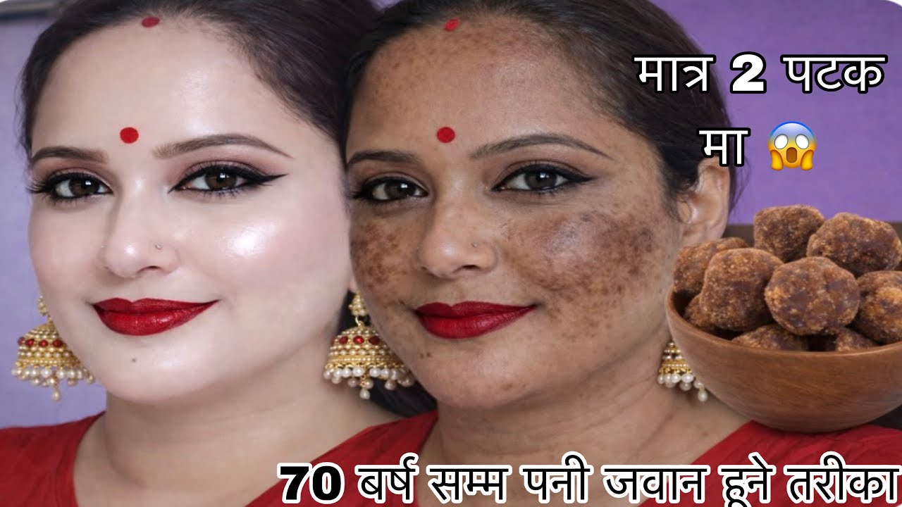 अनुहार सिशा जस्तै चम्कीलो/10 बर्ष पुरानो कालो चाया पोतो ग़ायब 😱#skincare 