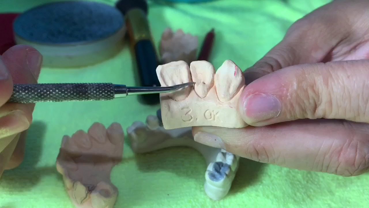 Características anatómicas dientes anteriores.