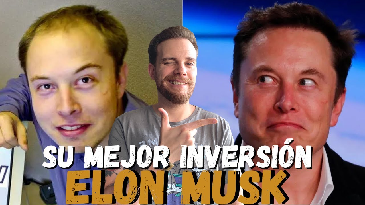 🧔 El sorprendente cambio de imagen de Elon Musk: ¿trasplante capilar o milagro?