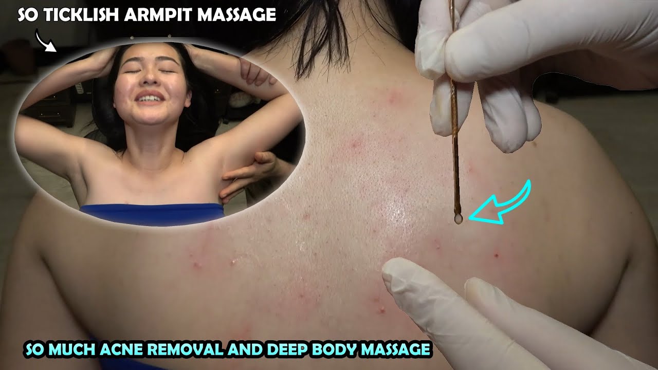 FEMALE SHOULDER DEEP ACNE REMOVAL + SO TICKLISH ARMPIT MASSAGE + CRACKS + ASMR Hip And Body Massage