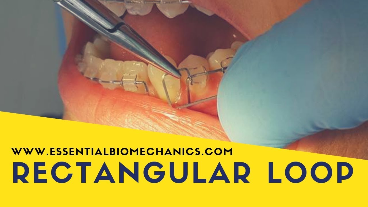 Rectangular loop | Essential Biomechanics