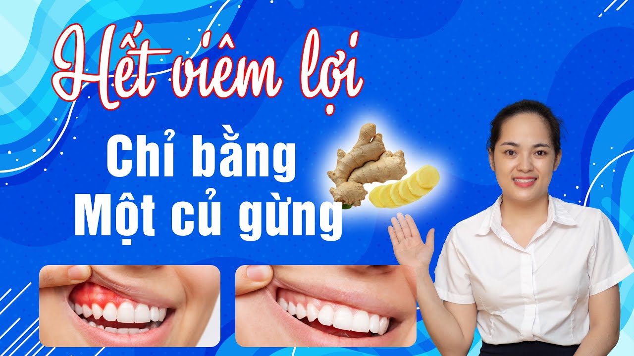 Cách Chữa Viêm Lợi Tại Nhà Bằng Gừng | Bác sĩ Thu Gia Lâm