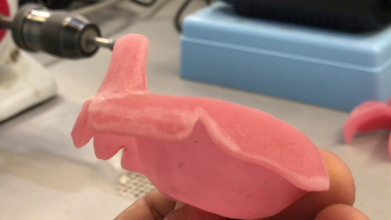 9b) Trimming Maxillary & Mandibular Custom Trays