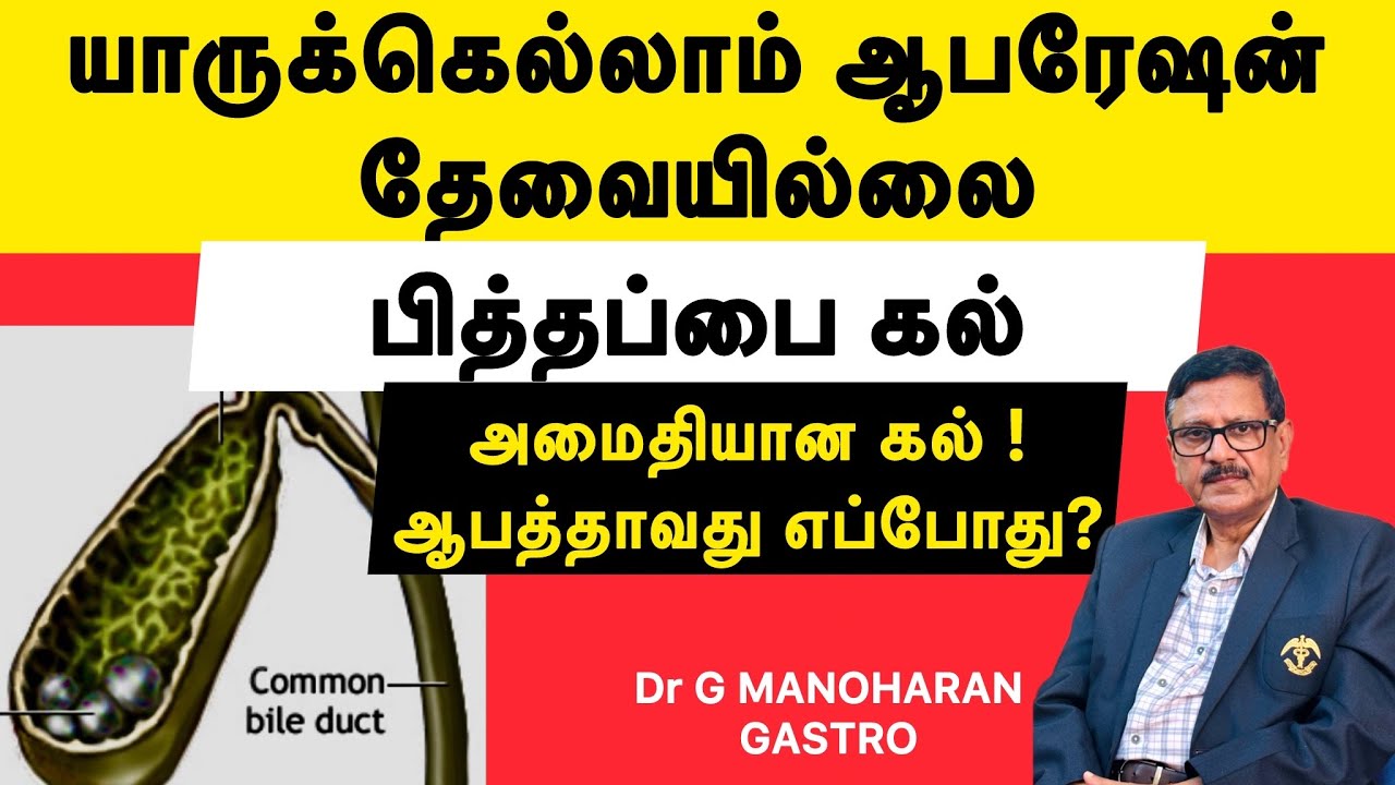 பித்தப்பை கல், யாருக்கெல்லாம் ஆபரேஷன் தேவையில்லை அமைதியான கல், ஆபத்தாவது எப்போது? Gall Bladder Stone