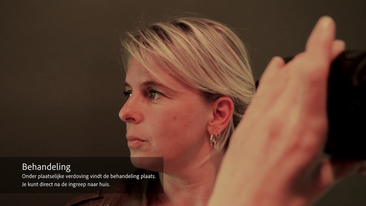 Bovenooglidcorrectie bij MOOI kliniek Maastricht