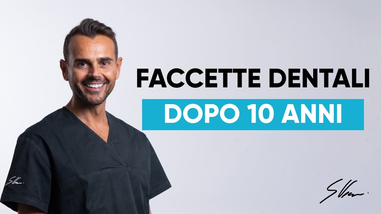FACCETTE DENTALI: durata e garanzia di successo a 10 anni