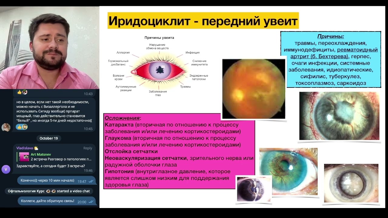Иридоциклит - демо превью-видео из нашего курса Фундаментальная офтальмология