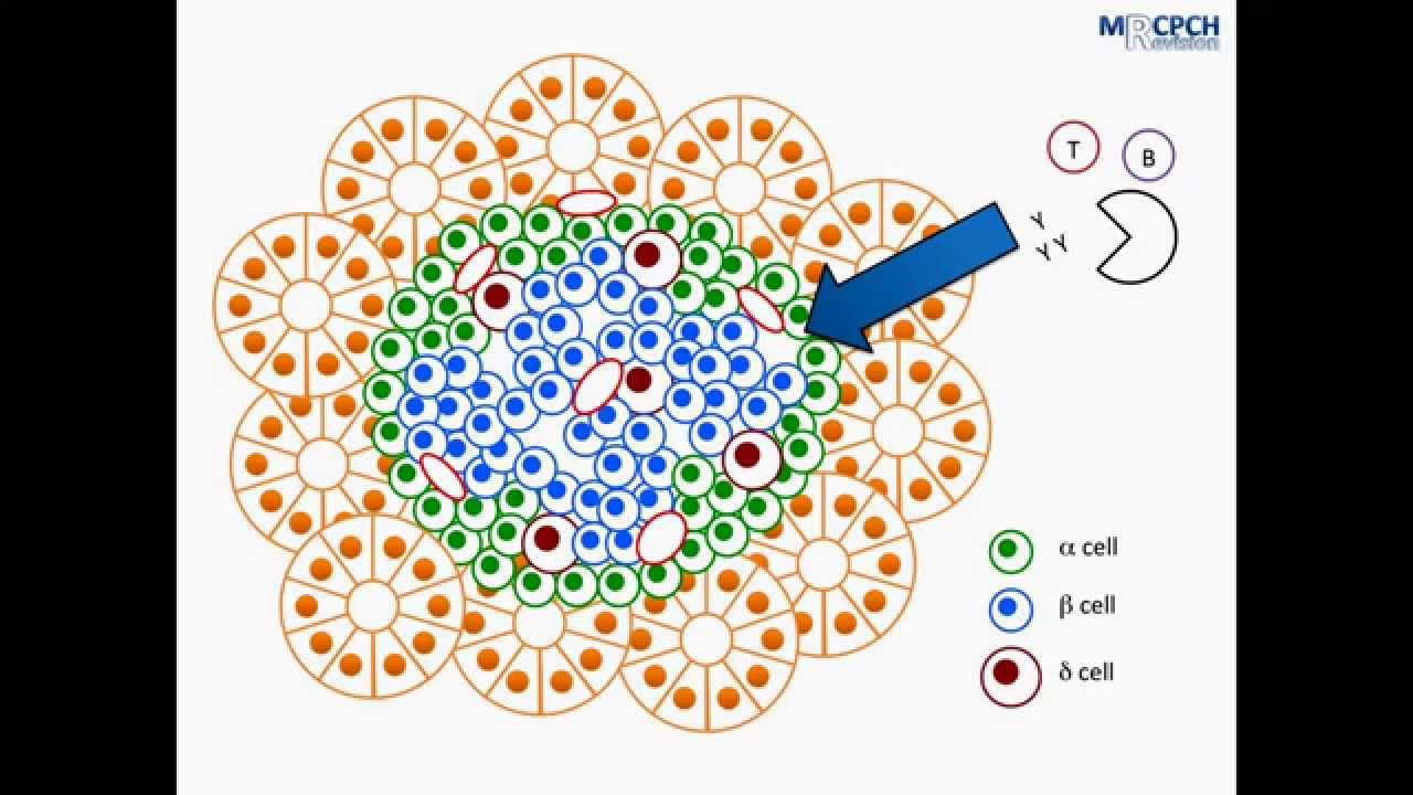 Pathophysiology of Type 1 Diabetes
