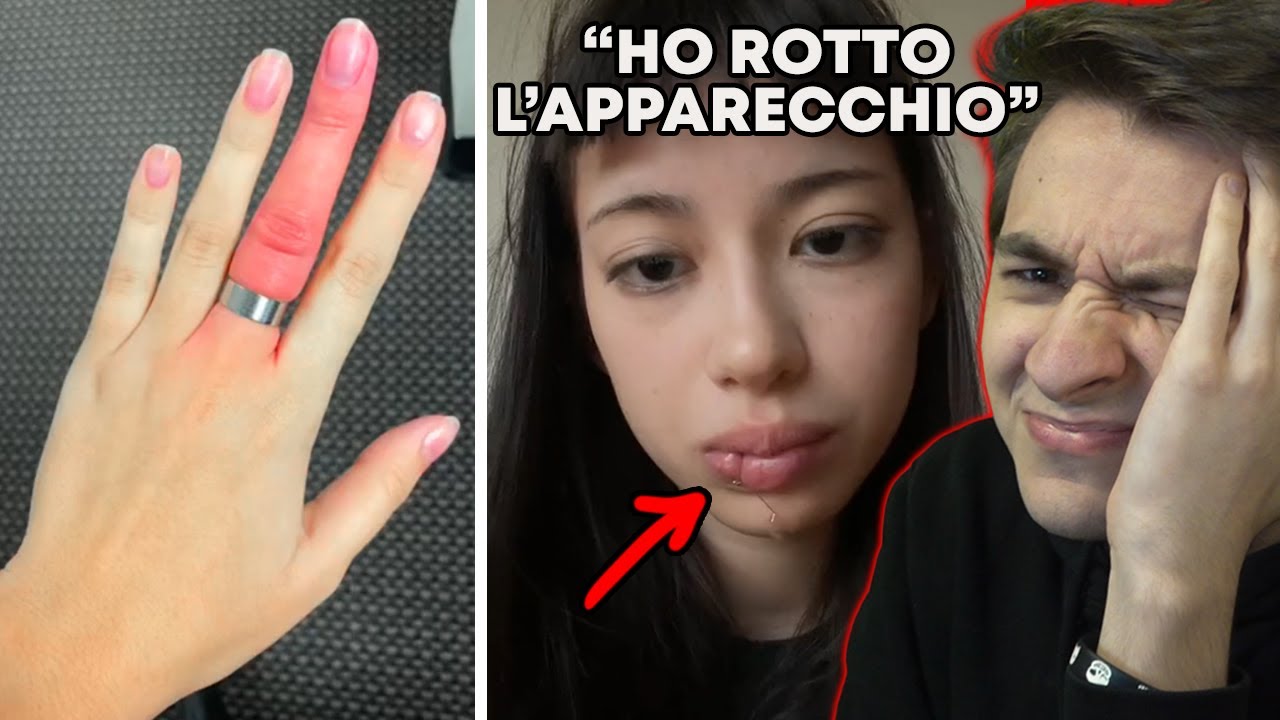Persone Che Hanno Avuto Una Pessima Giornata