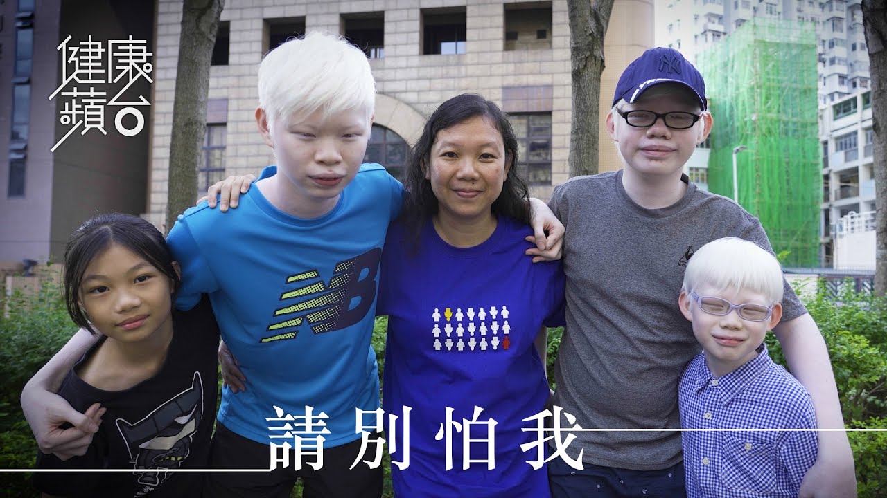 【白化病】全身白色途人見到即彈開 白化三兄弟：變相唔使排隊都幾好 (果籽)