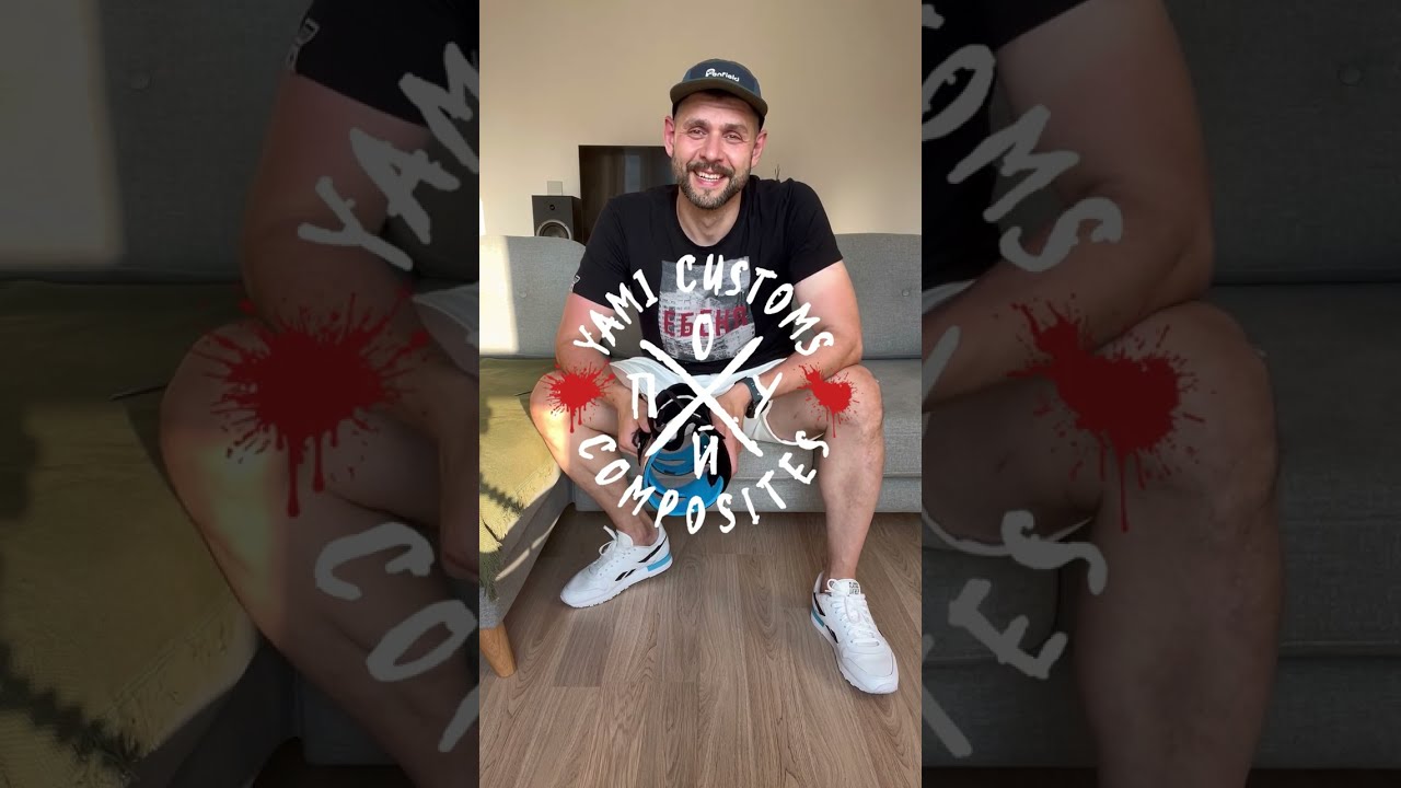 Что нужно сделать после покупки брейсов первым делом?