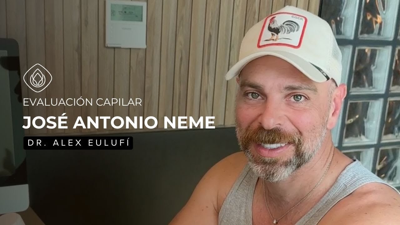 José Antonio Neme y su experiencia con el implante capilar en Clínica Lo Arcaya Unity.