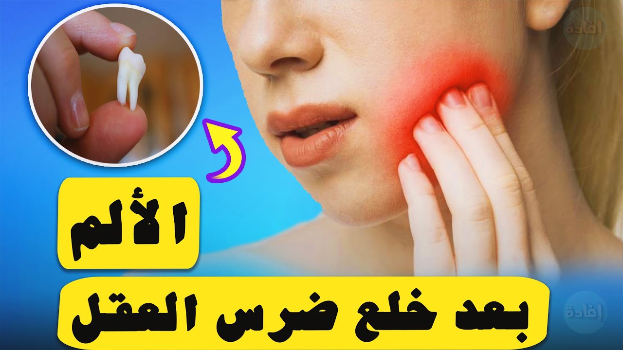 متى يخف الألم بعد خلع ضرس العقل ؟