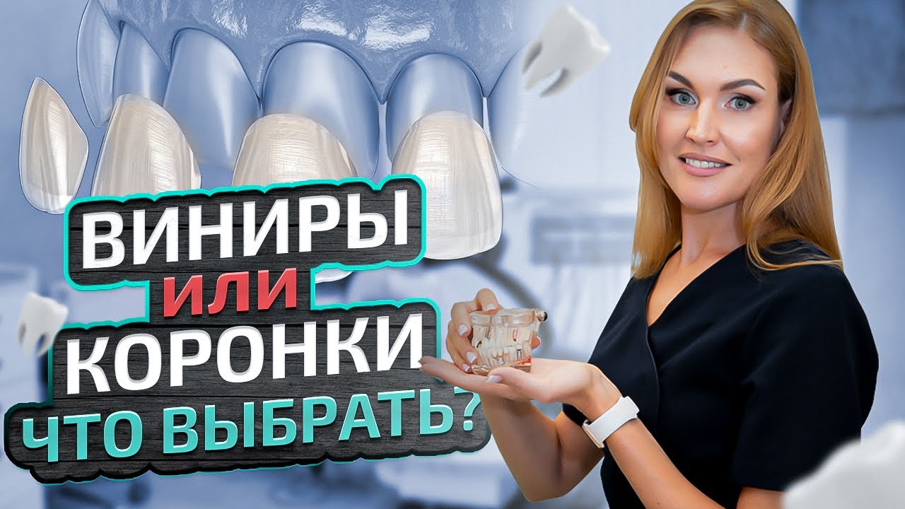Виниры или коронки: что лучше? В чем разница? Объясняет стоматолог-ортопед