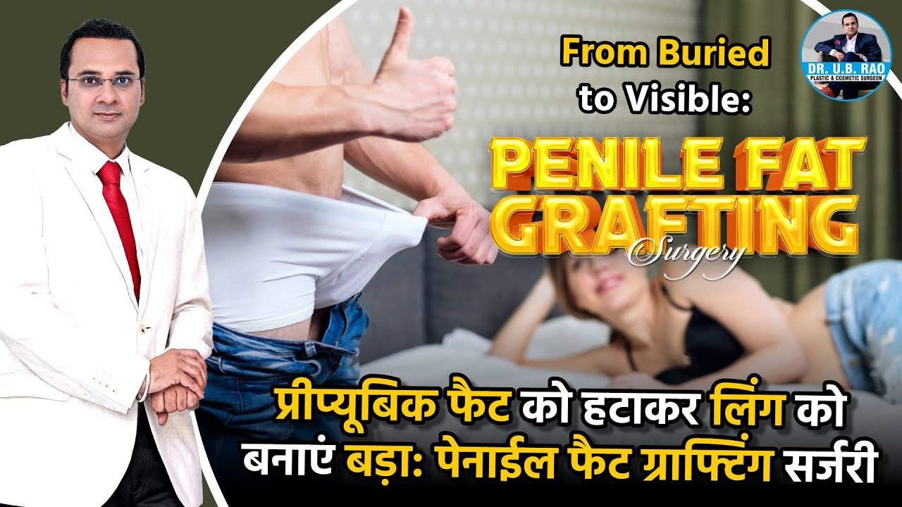 From Buried to Visible: Penile Fat Grafting Surgery | Transforming Buried Penis into a Visible One!