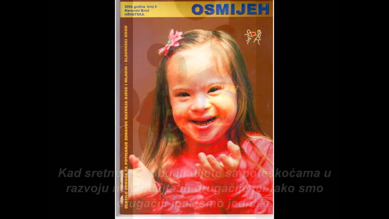 Djeca sa posebnim potrebama - Down Syndrom