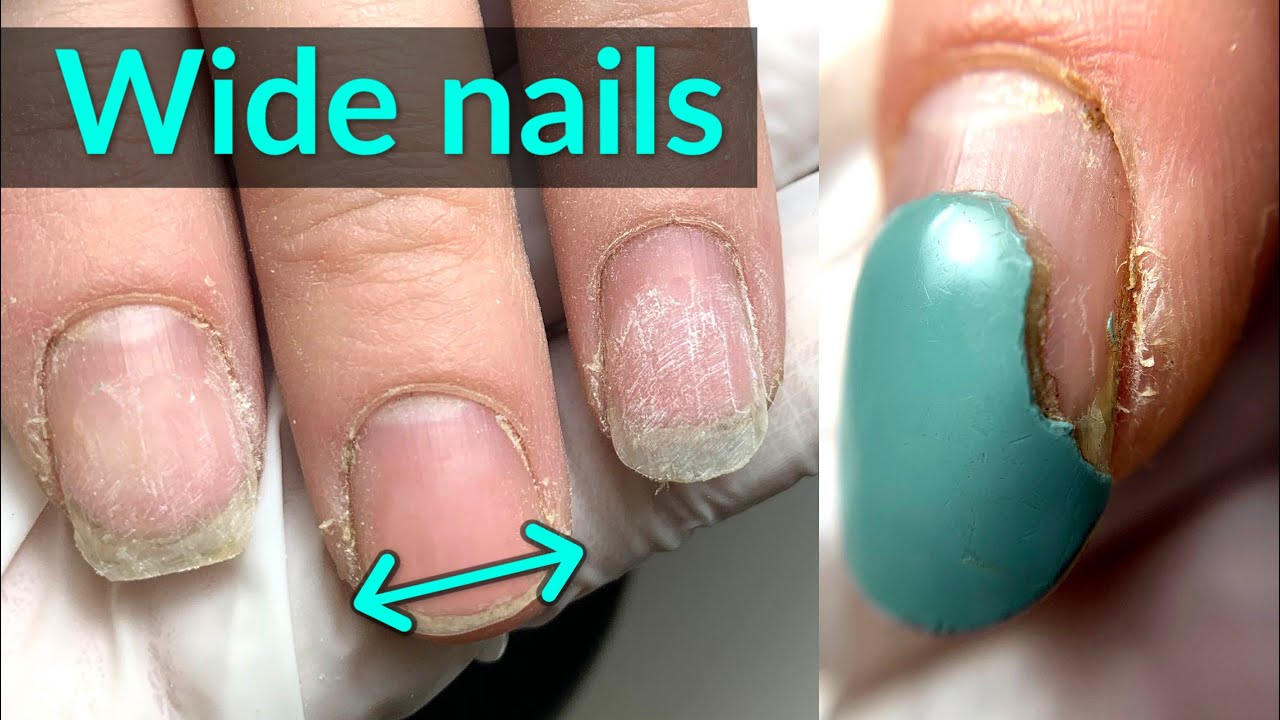 Wide Nails Transformation - Best Shape for Extensions