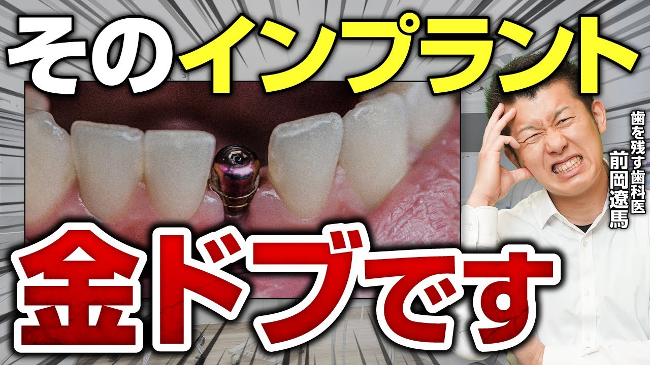 【警告】その50万円、ドブに捨てるつもりですか？インプラントを「高級なゴミ」にする人の共通点