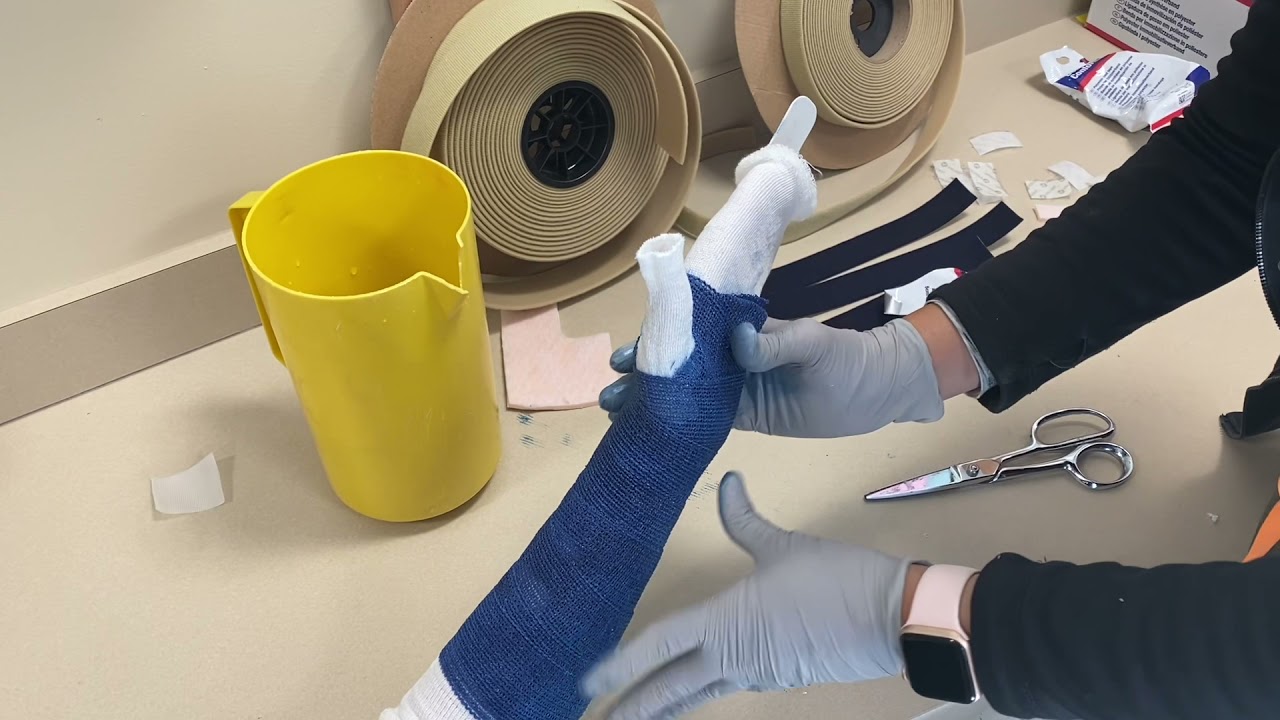 Wrist cock up splint with casting tape