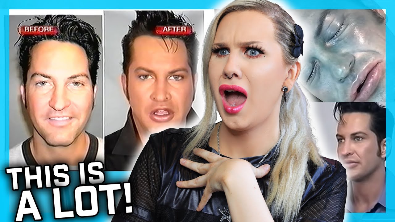 I WANT a Famous Face! To Look Like ELVIS! Another WILD plastic Surgery TV Show! @MTV
