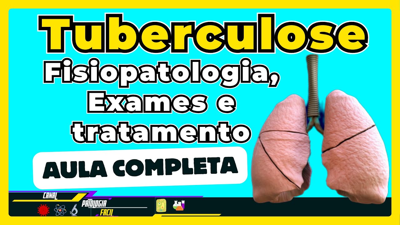 Tuberculose: Fisiopatologia, Fisiopatologia, Manifestações clínicas, Exames e Tratamento [ 2024 ]