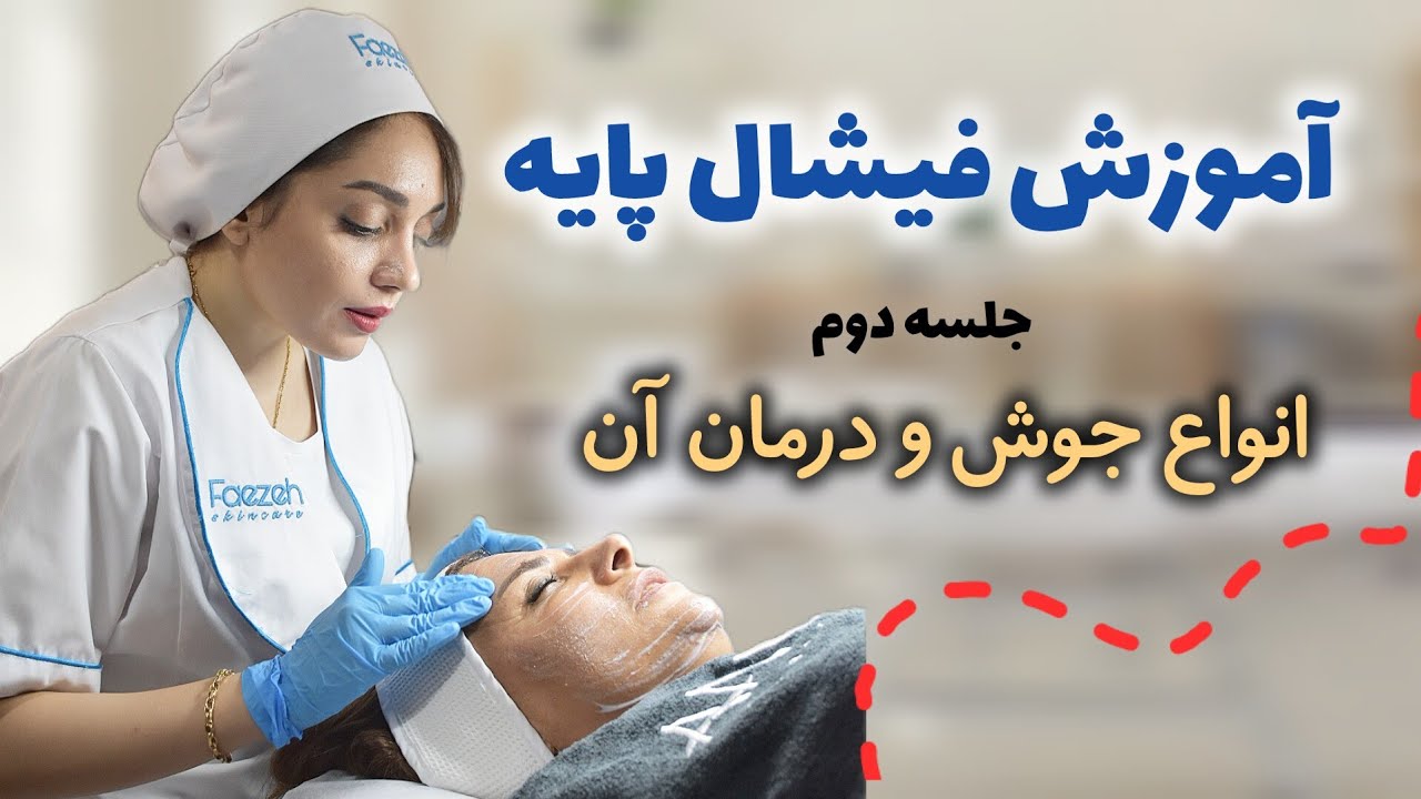 درمان جوش( جلسه۲)