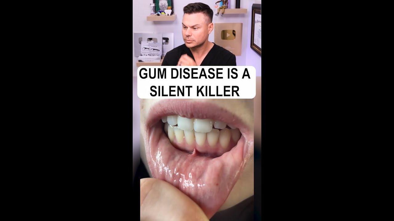 If you Have THIS, Your Gums COULD Be At Risk!