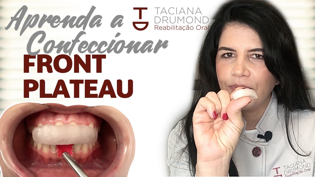 Você sabe confeccionar Front Plateau para obtenção da Relação Cêntrica? | Técnica, dicas e materiais