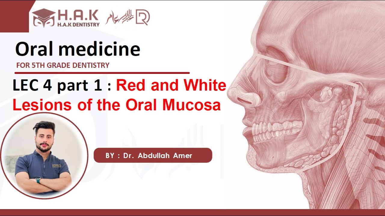 O.medicine | Lec 4 p1 | Red and White Lesions of the Oral Mucosa