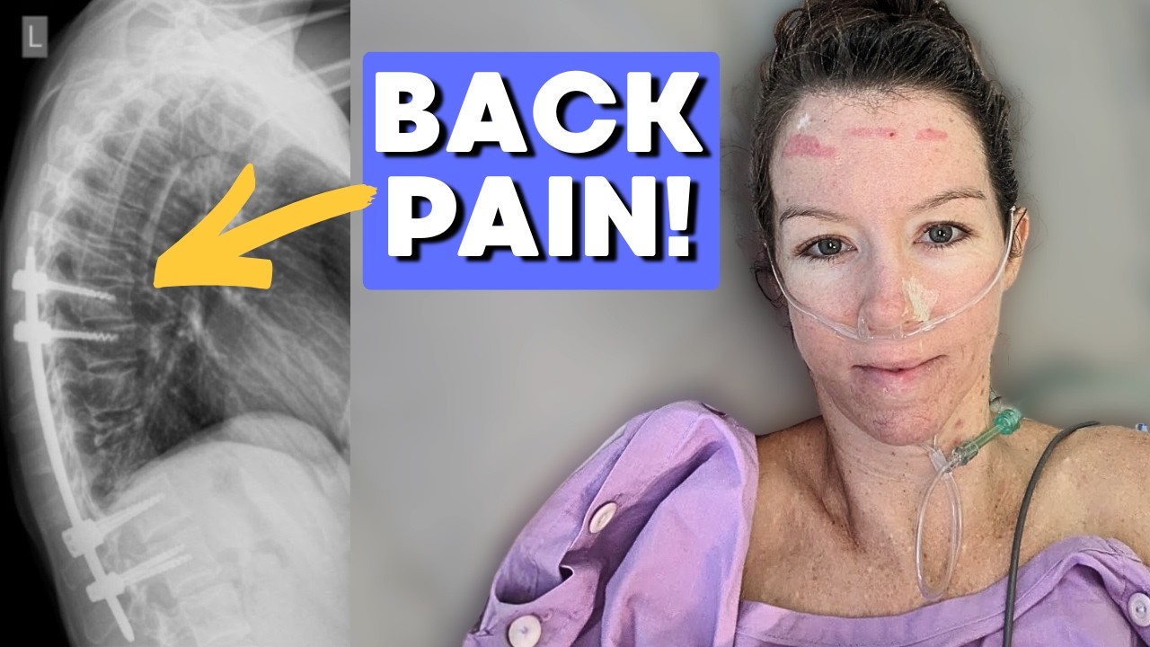 It Took 8 MONTHS To Figure Out I Had Metastatic MELANOMA! &ldquo;I had extreme back pain.&rdquo;