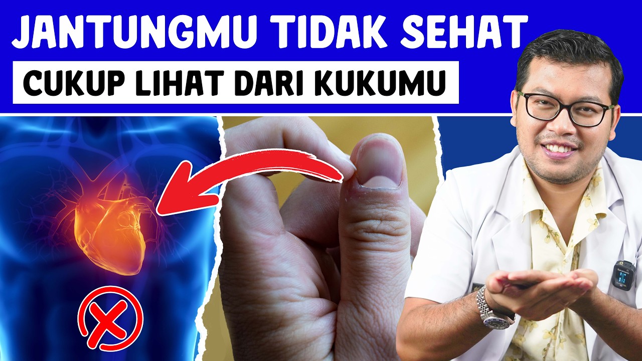 CIRI CIRI KUKU ORANG YANG MEMILIKI SAKIT JANTUNG - DOKTER SADDAM ISMAIL