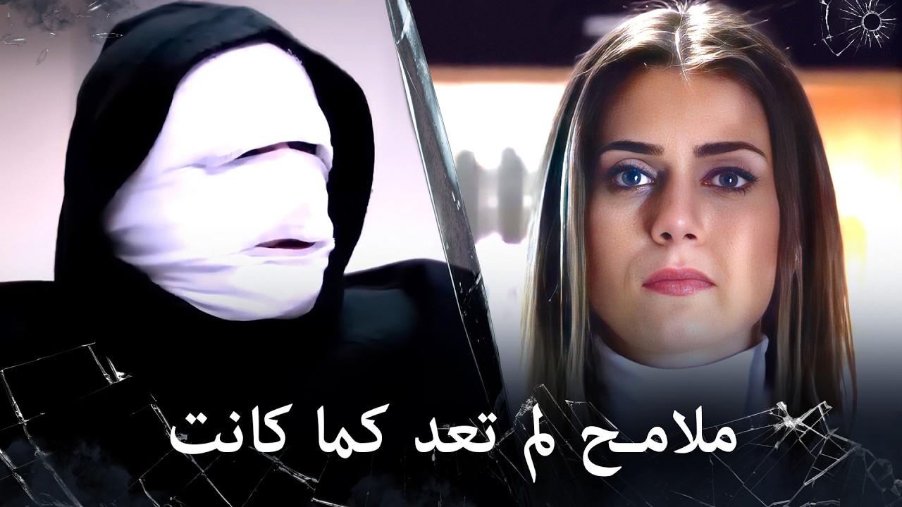 مراد علمدار - وجه مراد يتشوه بالكامل