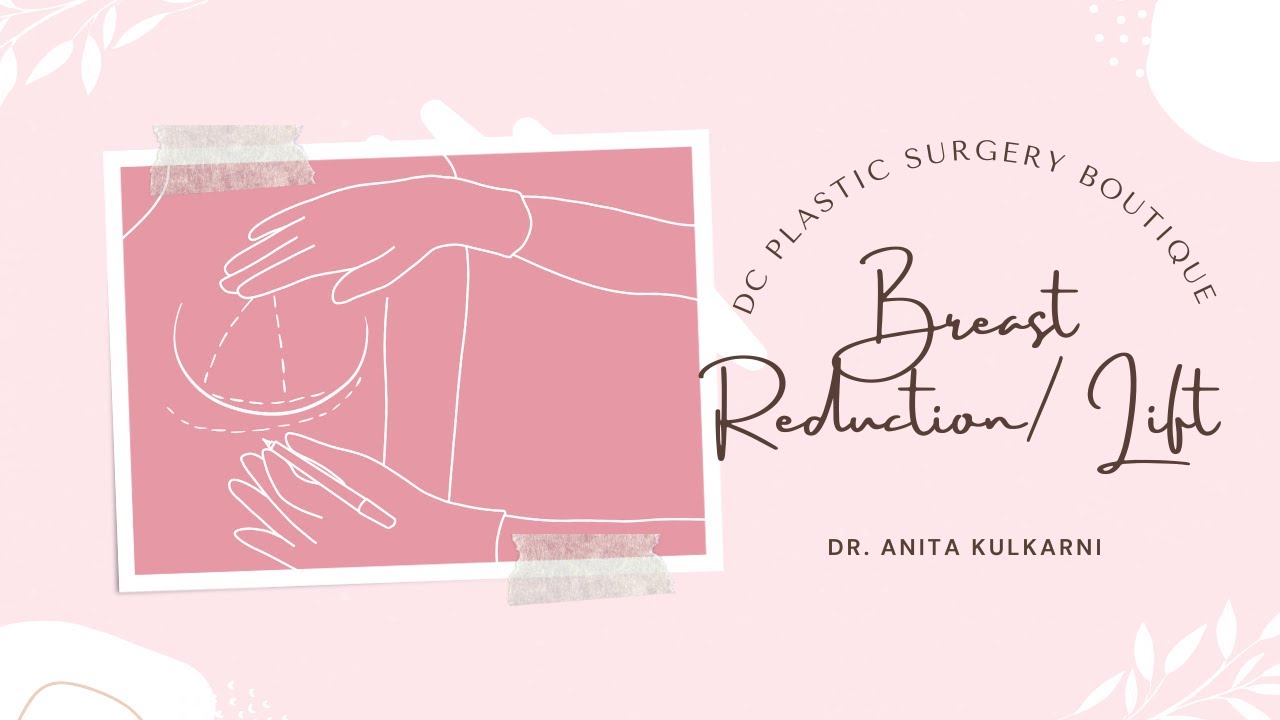 Breast Reduction/ Lift at DC Plastic Surgery Boutique
