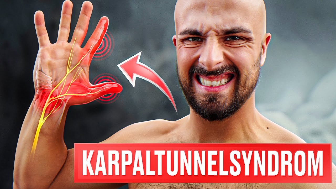 Karpaltunnelsyndrom | Die WAHRE Ursache + Lösung (Neuste Erkenntnisse)