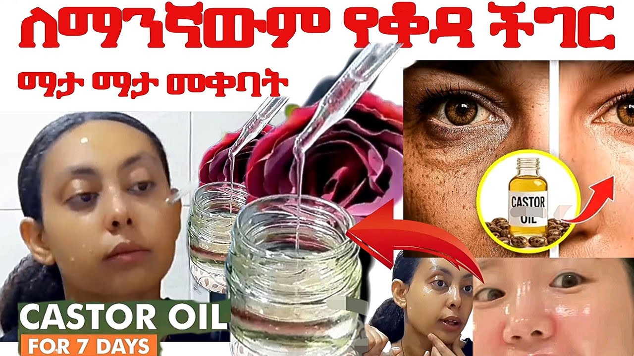 ለማንኛውም የቆዳ ችግር ማታ ማታ ተቀቡት Castor Oil for Your Face (Nature's Botox) #የቆዳማርጠቢያ@zizibeauty369n 