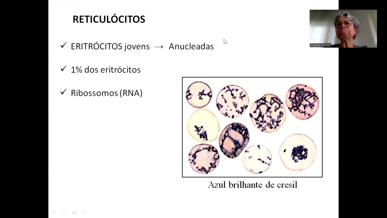 Aula Eritropoese, trombocitopoese e leucopoese