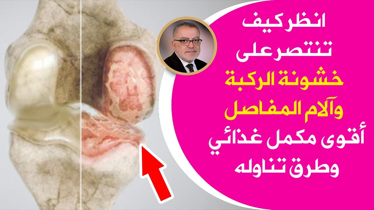الكولاجين أهم مكون لعظامك تناوله بهذه الطرق وانسى التهاب المفاصل هشاشة العظام خشونة الركب يقوي العظم