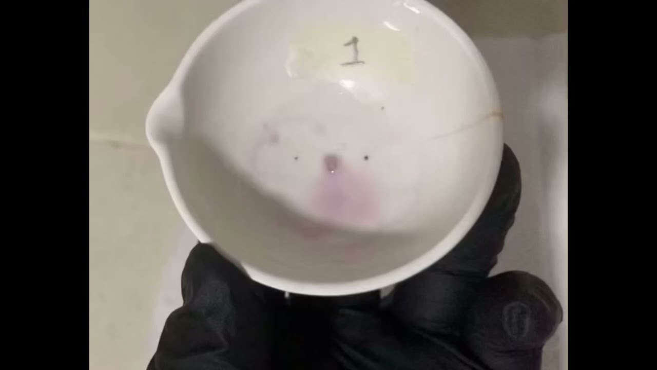 &iquest;C&oacute;mo se utiliza el Reactivo de Ehrlich? - Toxicolg&iacute;a