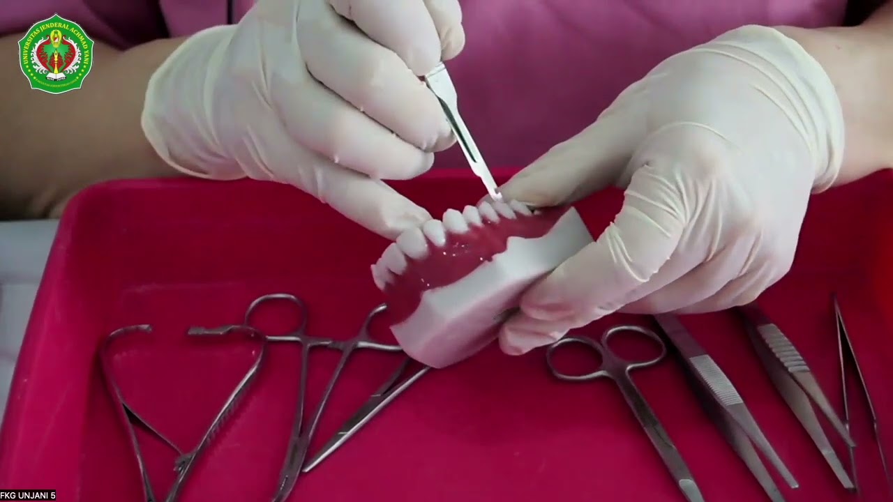 INCISI FLAP INTRA ORAL
